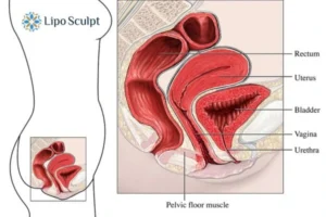 Treatment For A Leaky Bladder 2 How EM Chair treatment West Malling can help Leaky bladder issues. Read more now!
