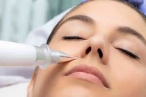 Best Actinic Keratoses Removal 3 Actinic keratoses West Malling solutions - book in today!
