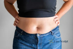Bidding Farewell to Muffin Tops with Aqualyx Fat Injections 2 Do you wish you could reduce your muffin top West Malling With Aqualy fat dissolving injections you can!
